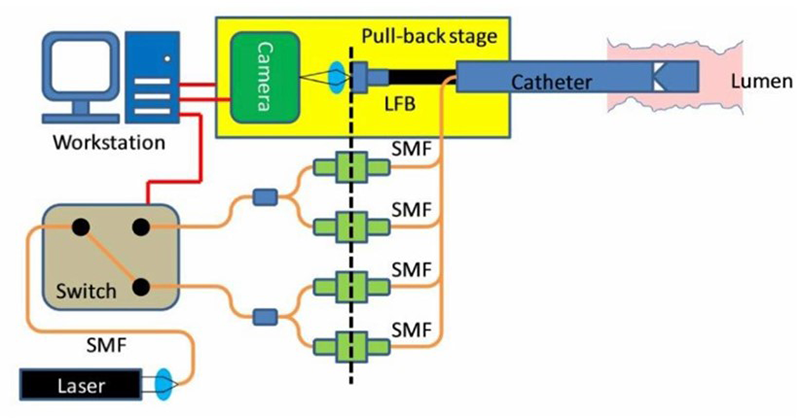 The schematic diagram of the omnidirectional LSR catheter shows the pull-back assembly and console hardware. Laser light coupled into a single mode fiber (SMF) passes through a MEMS switch and is split into 4 illumination fibers. The speckle patterns obtained from the lumen wall are transmitted through an optical fiber bundle (OFB) and imaged on the CMOS camera (image courtesy of Optical Society of America).