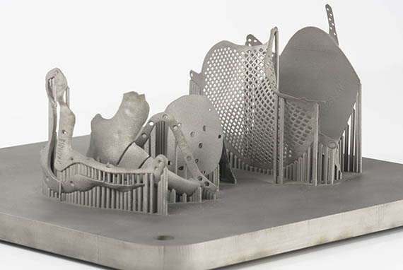 Is the Medical Device Regulation a Threat to Additive Manufacturing?