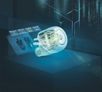 Siemens makes additive manufacturing capabilities, 3D printers available to medical community